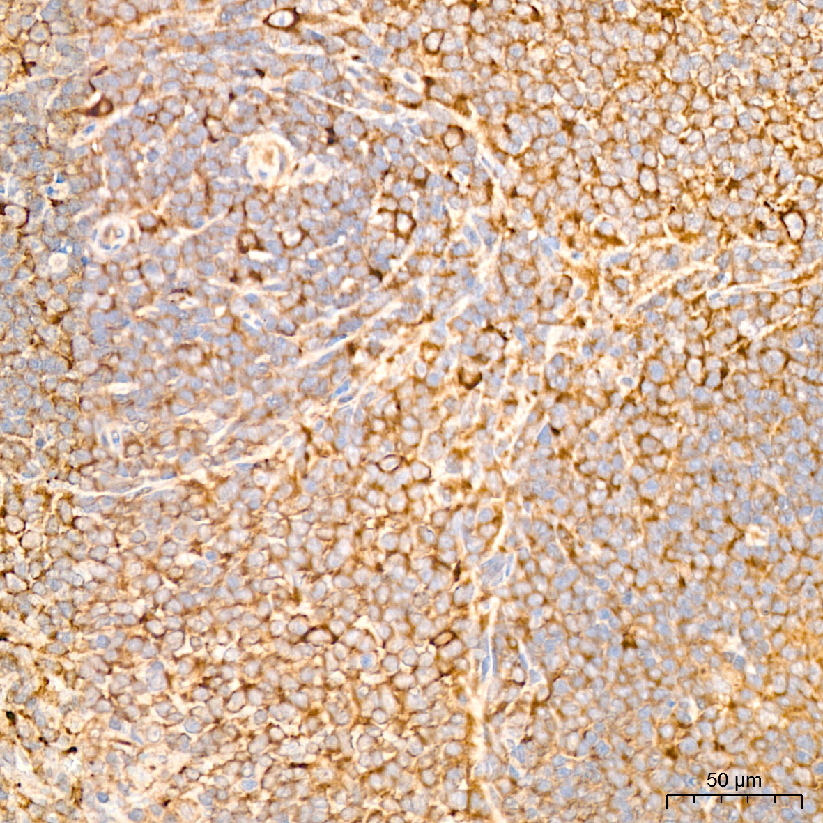 ma5ページ IL11RA Rabbit mAb
