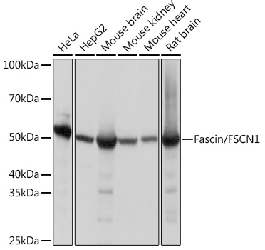 Fascin/FSCN1 Rabbit mAb