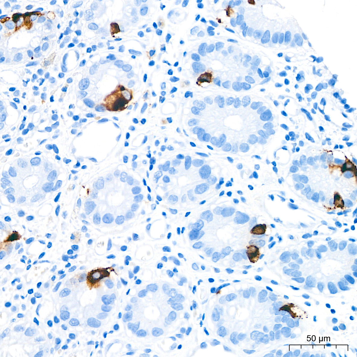 Chromogranin A Rabbit mAb