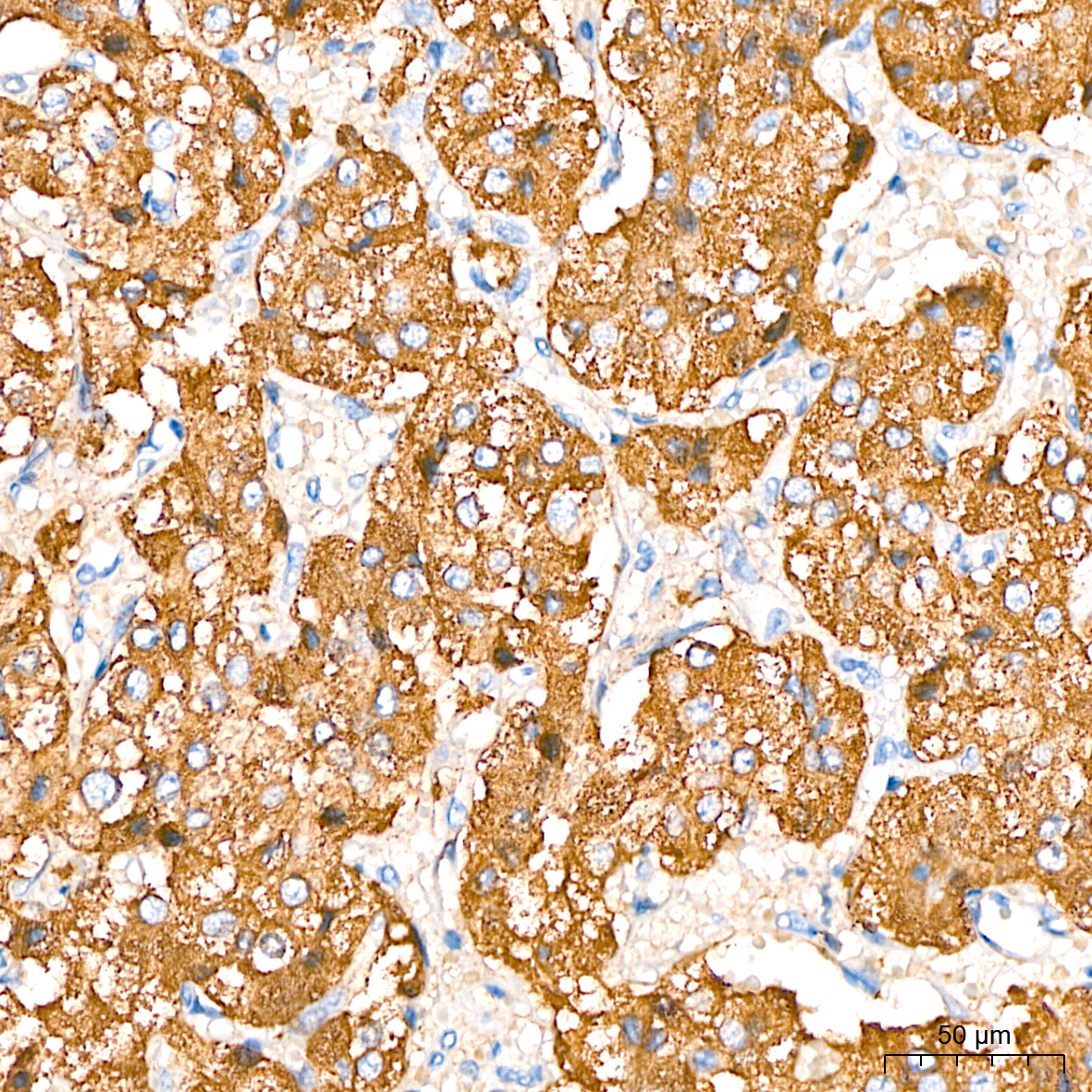 Chromogranin A Rabbit mAb
