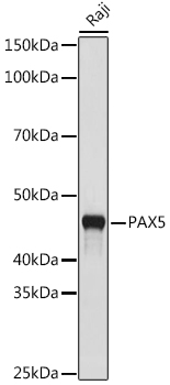 PAX5 Rabbit mAb