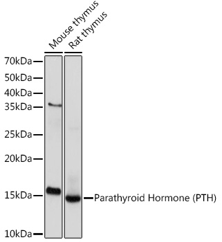 Parathyroid Hormone (PTH) Rabbit mAb