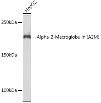 Alpha-2-Macroglobulin (A2M) Rabbit mAb