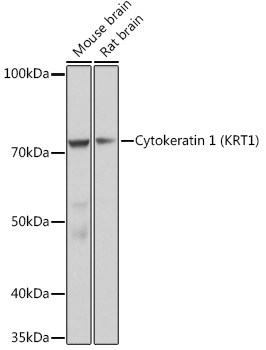 Cytokeratin 1 (KRT1) Rabbit mAb