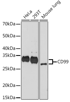 CD99 Rabbit mAb