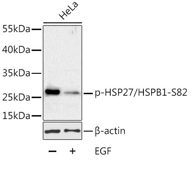 Phospho-HSP27/HSPB1-S82 Rabbit pAb