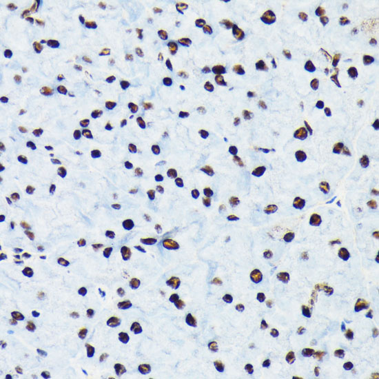 Phospho-RB-S780 Rabbit mAb