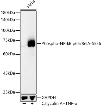 Phospho-NF-kB p65/RelA-S536 Rabbit mAb