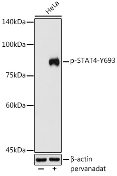 Phospho-STAT4-Y693 Rabbit pAb