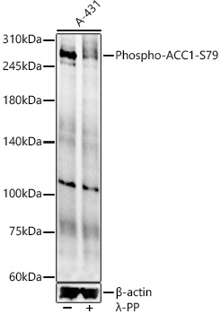 Phospho-ACC1-S79 Rabbit pAb