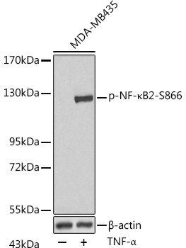 Phospho-NF-κB2-S866 Rabbit pAb