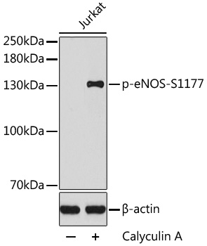 Phospho-eNOS-S1177 Rabbit pAb