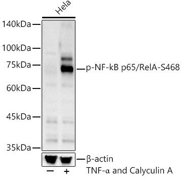 Phospho-NF-kB p65/RelA-S468 Rabbit pAb