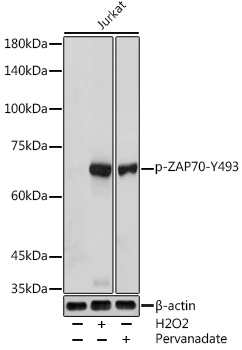 Phospho-ZAP70-Y493 Rabbit pAb