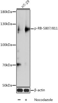 Phospho-RB-S807/811 Rabbit pAb