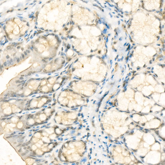 Apple様 Phospho-YAP1-S127 Rabbit pAb