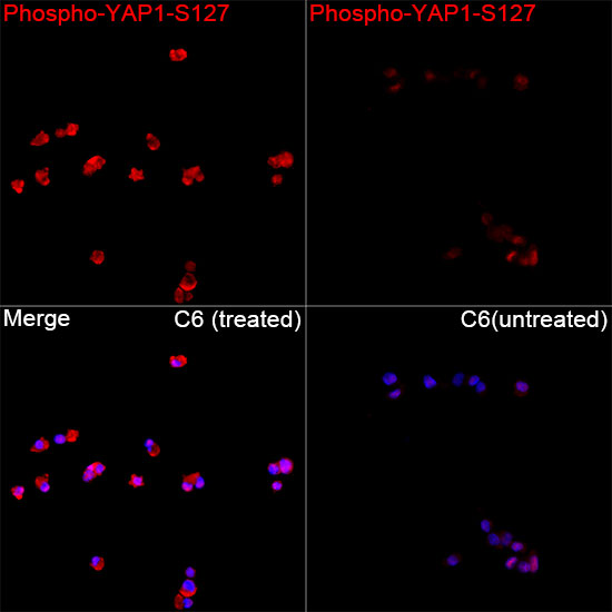 Phospho-YAP1-S127 Rabbit pAb