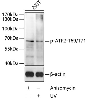 Phospho-ATF2-T69/T71 Rabbit pAb