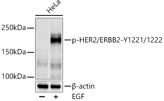 Phospho-HER2/ErbB2-Y1221/1222 Rabbit pAb