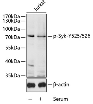 syk ページ ABclonal