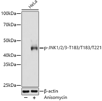 Phospho-JNK1/2/3-T183/T183/T221 Rabbit mAb