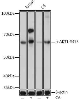 初売り初売り Phospho-AKT-S473 Rabbit mAb ブルーレイプレーヤー・レコーダー