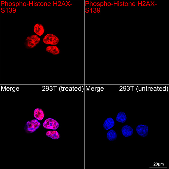 Phospho-Histone H2AX-S139 Rabbit mAb