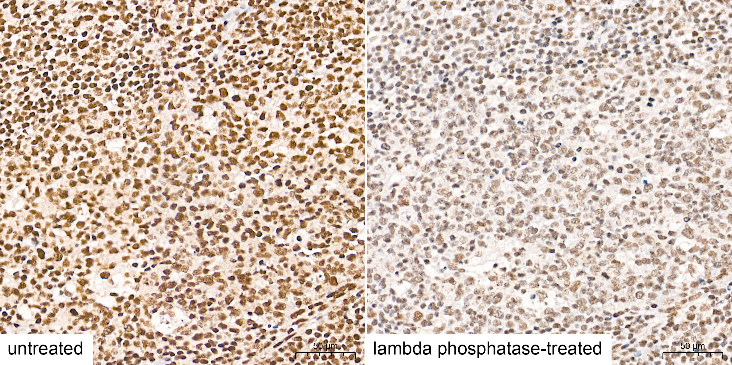 Phospho-STAT3-Y705 Rabbit mAb