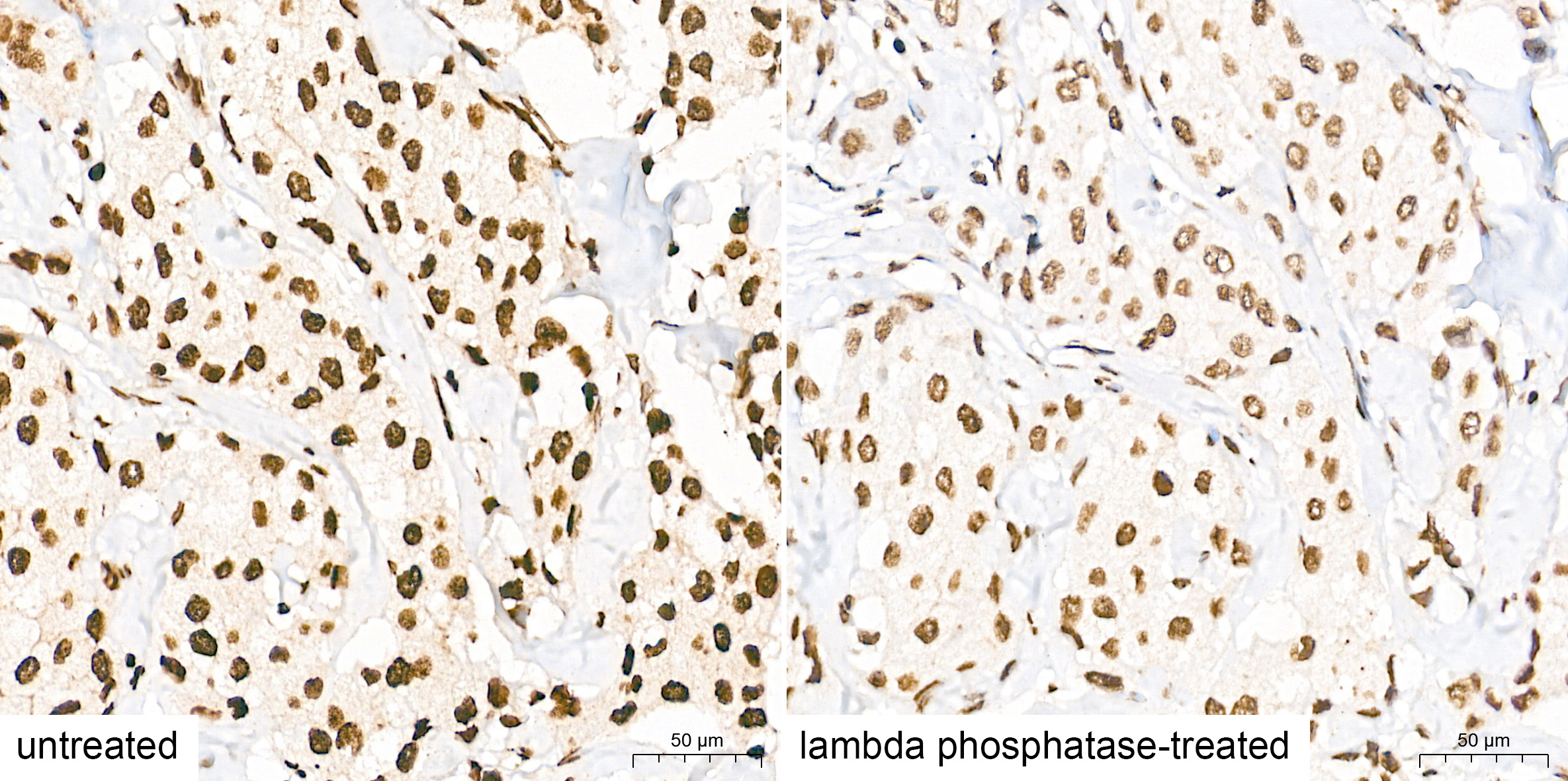 Phospho-STAT3-Y705 Rabbit mAb