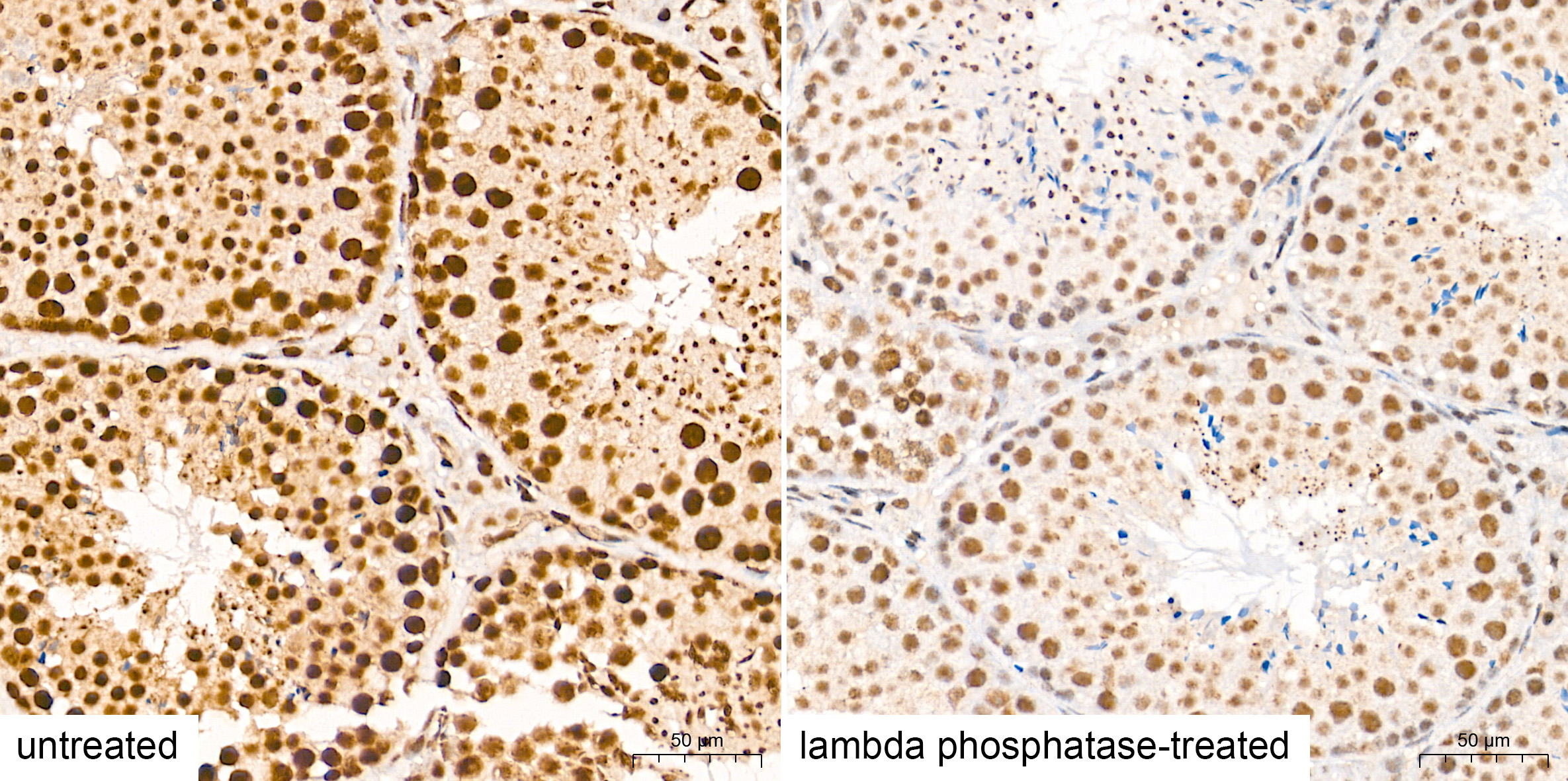 Phospho-STAT3-Y705 Rabbit mAb