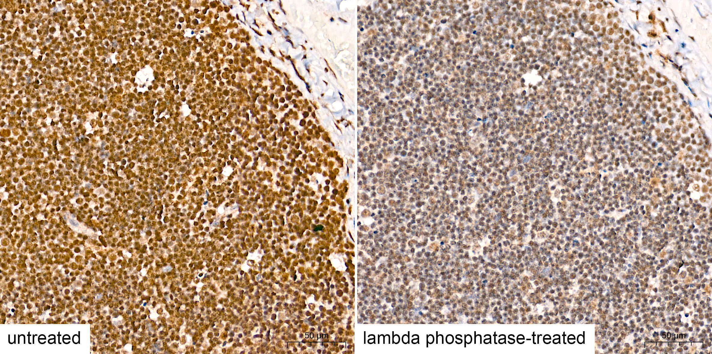 Phospho-STAT3-Y705 Rabbit mAb