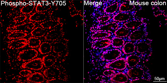 Phospho-STAT3-Y705 Rabbit mAb