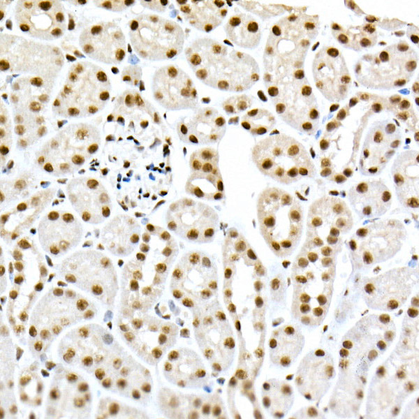 【貴重】adaptoid アダプトイド Anti-Androgen Receptor (ARv7 Splice Variant) antibody
