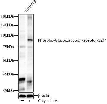 Phospho-Glucocorticoid Receptor-S211 Rabbit pAb