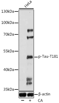 Phospho-Tau-T181 Rabbit pAb