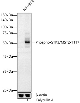 Phospho-STK3/MST2-T117 Rabbit pAb