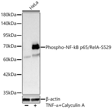 Phospho-NF-kB p65/RelA-S529 Rabbit pAb