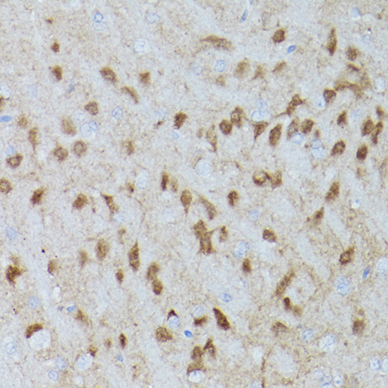 Phospho-ERK1-T202/Y204 + ERK2-T185/Y187 Rabbit mAb