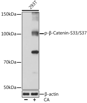 Phospho-β-Catenin-S33/S37 Rabbit mAb