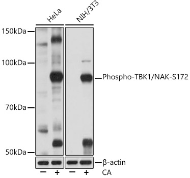 Phospho-TBK1/NAK-S172 Rabbit mAb