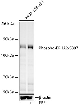 Phospho-EPHA2-S897 Rabbit pAb