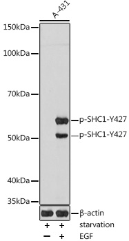 Phospho-SHC1-Y427 Rabbit pAb