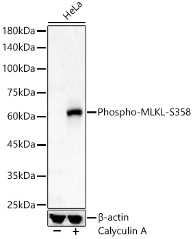 Phospho-MLKL-S358 Rabbit pAb-Phosphorylated Antibodies - ABclonal/拜爾國際 ...