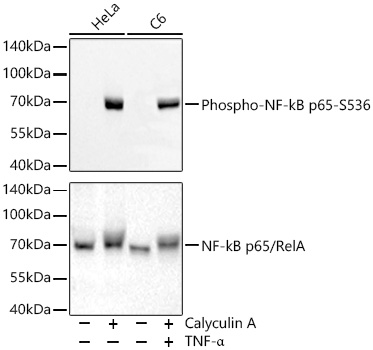 Phospho-NF-kB p65/RelA-S536 Rabbit mAb