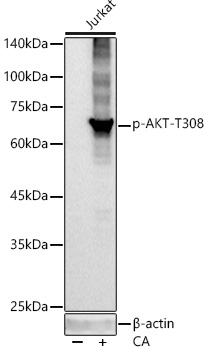 Phospho-Akt-T308 Rabbit mAb