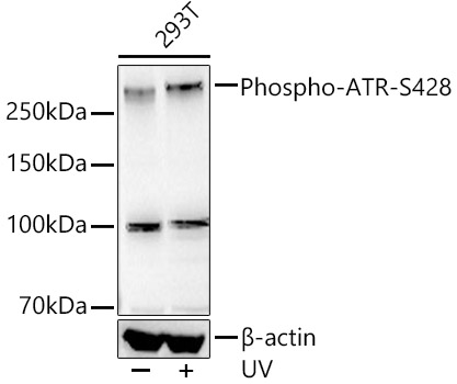 Phospho-ATR-S428 Rabbit mAb