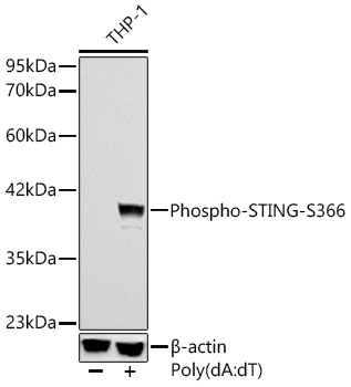 Phospho-STING/TMEM173-S366 Rabbit mAb