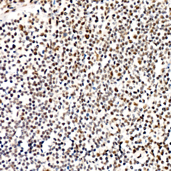 Phospho-PERK-T982 Rabbit mAb