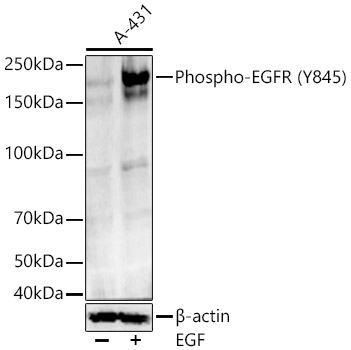 Phospho-EGFR-Y845 Rabbit mAb