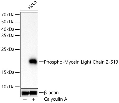 Phospho-Myosin Light Chain 2-S19 Rabbit mAb